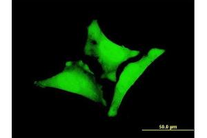 Immunofluorescence of monoclonal antibody to WBP1 on HeLa cell. (WBP1 antibody  (AA 170-267))