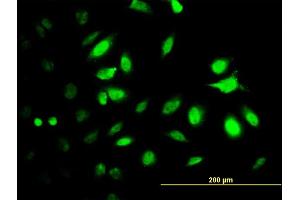 Immunofluorescence of monoclonal antibody to PSMC2 on HeLa cell. (PSMC2 antibody  (AA 1-433))