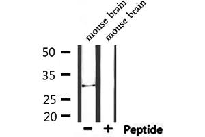 Western blot analysis of extracts from mouse brain, using IL1A Antibody. (IL1A antibody  (N-Term))