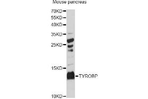 Western blot analysis of extracts of mouse pancreas, using TYROBP antibody (ABIN6291980) at 1:3000 dilution. (TYROBP antibody)