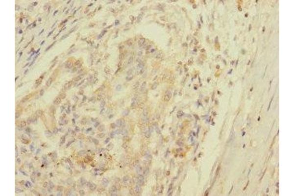 SPC25 antibody  (AA 1-224)