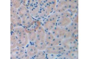 Figure. (TIMP3 antibody  (AA 27-209))