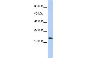 WB Suggested Anti-FAM14A Antibody Titration:  0. (IFI27L2 antibody  (Middle Region))