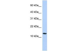 WB Suggested Anti-FAM14A Antibody Titration:  0.