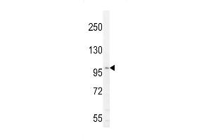 Western Blotting (WB) image for anti-Interleukin 6 Signal Transducer (Gp130, Oncostatin M Receptor) (IL6ST) (AA 871-899), (C-Term) antibody (ABIN655059)