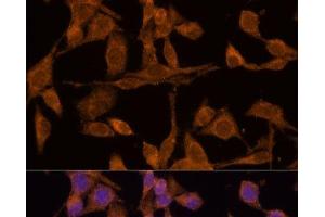 Immunofluorescence analysis of HeLa cells using USP15 Polyclonal Antibody at dilution of 1:100 (40x lens). (USP15 antibody)