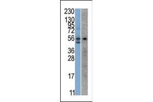 The anti-STK38 Pab (ABIN391097 and ABIN2841236) is used in Western blot to detect STK38 in SK-Br-3 (left) and Jurkat (right) cell line lysates.