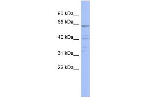 WB Suggested Anti-ZNF689 Antibody Titration:  0.