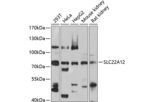 SLC22A12 Antikörper  (AA 30-150)