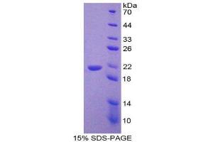 SDS-PAGE (SDS) image for Corticotropin Releasing Hormone (CRH) (AA 40-195) protein (His tag) (ABIN2124510)