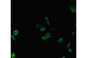 Immunofluorescent analysis of Hela cells using ABIN7145087 at dilution of 1:100 and Alexa Fluor 488-congugated AffiniPure Goat Anti-Rabbit IgG(H+L) (AIRE antibody  (AA 39-108))