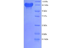 SDS-PAGE (SDS) image for Phosphogluconate Dehydrogenase (PGD) (AA 4-483), (partial) protein (GST tag) (ABIN5712117) (PGD Protein (AA 4-483, partial) (GST tag))