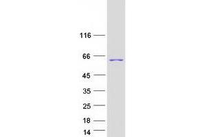 Validation with Western Blot (DBNL Protein (Transcript Variant 2) (Myc-DYKDDDDK Tag))