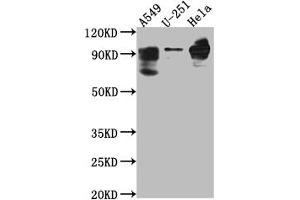 Western Blot Positive WB detected in: THP-1 whole cell lysate All lanes: PDE4D antibody at 1:1000 Secondary Goat polyclonal to rabbit IgG at 1/50000 dilution Predicted band size: 92, 77, 69, 67, 58, 85, 24, 60, 78, 77, 85, 25 kDa Observed band size: 92 kDa (Recombinant PDE4D antibody)
