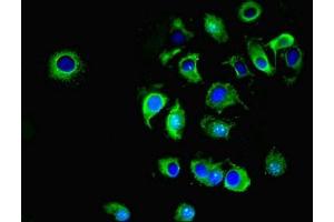 Immunofluorescent analysis of MCF-7 cells using ABIN7170036 at dilution of 1:100 and Alexa Fluor 488-congugated AffiniPure Goat Anti-Rabbit IgG(H+L) (ATP1A1 antibody  (AA 225-407))