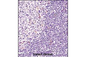 BTK Antibody (N-term) (ABIN657469 and ABIN2846497) immunohistochemistry analysis in formalin fixed and paraffin embedded human tonsil tissue followed by peroxidase conjugation of the secondary antibody and DAB staining. (BTK antibody  (N-Term))