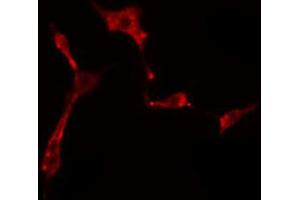 ABIN6274500 staining HeLa cells by IF/ICC. (ZNF436 antibody  (C-Term))