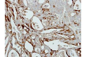 IHC-P Image Immunohistochemical analysis of paraffin-embedded NCIN87 xenograft, using Collagen III alpha1, antibody at 1:500 dilution. (COL3A1 antibody  (C-Term))