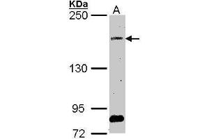 WB Image Sample (30 ug of whole cell lysate) A: A549 5% SDS PAGE antibody diluted at 1:1000 (SOS2 antibody  (Center))