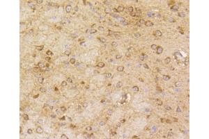 Immunohistochemistry of paraffin-embedded mouse brain using ARRB1 antibody (ABIN4903044) at dilution of 1:100 (40x lens).