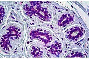 Human Breast: Formalin-Fixed, Paraffin-Embedded (FFPE) (CRY1 antibody  (AA 1-587))
