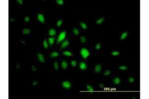 Immunofluorescence of monoclonal antibody to HMG20B on HeLa cell. (HMG20B antibody  (AA 1-109))