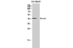 Western Blotting (WB) image for anti-Hexamethylene Bis-Acetamide Inducible 1 (HEXIM1) (Internal Region) antibody (ABIN3184999)