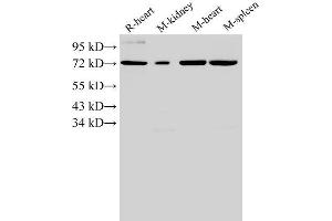 Western Blotting (WB) image for anti-Annexin A6 (ANXA6) antibody (ABIN7234042) (ANXA6 antibody)