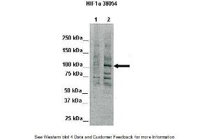 Lanes:   Lane 1: 80ug Chicken liver (nuclei)  Primary Antibody Dilution:   1:1000  Secondary Antibody:   Goat anti-rabbit IgG  Secondary Antibody Dilution:   1:2,000  Gene Name:   HIF1A  Submitted by:   Silvia Moore, Weill Medical College of Cornell University