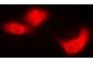 Immunofluorescent analysis of EIF6 staining in Hela cells. (EIF6 antibody)