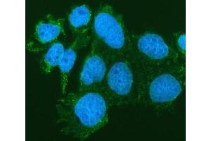IF analysis of SIAE using anti-SIAE antibody (ABIN7600774). (SIAE antibody  (AA 230-523))