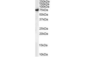 Image no. 1 for anti-Syntaxin Binding Protein 1 (STXBP1) (C-Term) antibody (ABIN374370) (STXBP1 antibody  (C-Term))