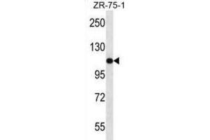 Western Blotting (WB) image for anti-USO1 Homolog, Vesicle Docking Protein (USO1) antibody (ABIN2997687)