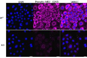 Immunocytochemical staining of HeLa cells using Phospho-MEK1 (S298) antibody (ABIN7799462), 1:1,000), Top panel: wild-type (WT), Bottom panal: Phospho-MEK1 (S298) shRNA knockdown (KD). (Recombinant MEK1 antibody  (pSer298))