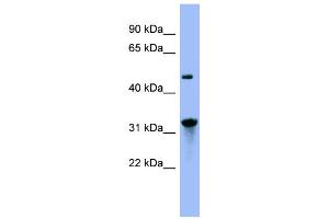 WB Suggested Anti-NIT1 Antibody Titration: 0. (Nitrilase 1 antibody  (N-Term))