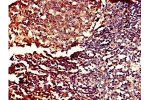 Immunohistochemistry of paraffin-embedded human tonsil tissue using ABIN7150681 at dilution of 1:100 (PDE11A antibody  (AA 42-190))