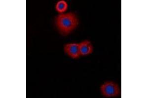 Immunofluorescent analysis of CLIP3 staining in A549 cells. (CLIP3 antibody)