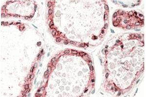 AP31686PU-N (5 µg/ml) staining of paraffin embedded Human Thyroid Gland. (Thyroperoxidase antibody  (Internal Region))