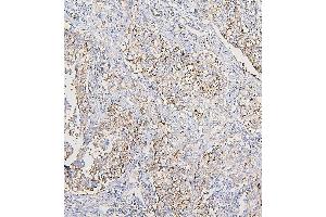 IHC analysis of COPE using anti-COPE antibody (ABIN7602509). (COPE antibody  (AA 80-308))