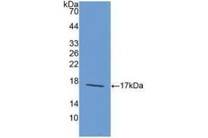 Western blot analysis of recombinant Rat LAMa1. (Laminin alpha 1 antibody  (AA 1156-1276))