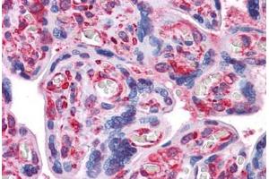 Human Placenta: Formalin-Fixed, Paraffin-Embedded (FFPE) (alpha Tubulin antibody)