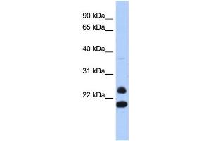 WB Suggested Anti-NEUROG2 Antibody Titration:  0.