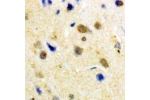 Immunohistochemical analysis of S100-A1 staining in human brain formalin fixed paraffin embedded tissue section. (S100A1 antibody)