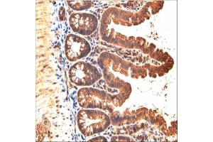 IHC-P Image Immunohistochemical analysis of paraffin-embedded mouse small intestine, using JAM-B, antibody at 1:200 dilution.