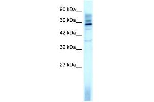 WB Suggested Anti-TAF15 Antibody Titration: 3. (TAF15 antibody  (N-Term))