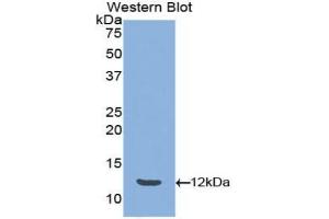 Western blot analysis of the recombinant protein. (Peptide YY antibody  (AA 30-98))