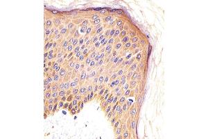 Paraformaldehyde-fixed, paraffin embedded human skin tissue, Antigen retrieval by boiling in sodium citrate buffer (pH6. (CSF1R antibody)