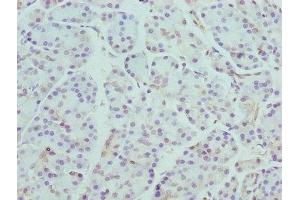 Immunohistochemistry of paraffin-embedded human pancreatic tissue using ABIN7145930 at dilution of 1:100 (CCR4 antibody  (AA 309-360))