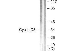 Immunohistochemical analysis of paraffin-embedded human lung carcinoma tissue using Cyclin D3 (Ab-283) antibody. (Cyclin D3 antibody  (Thr283))