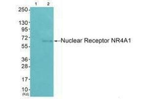 Western blot analysis of extracts from HepG2 cells (Lane 2), using Nuclear Receptor NR4A1 (Ab-351) antiobdy. (NR4A1 antibody  (Ser351))